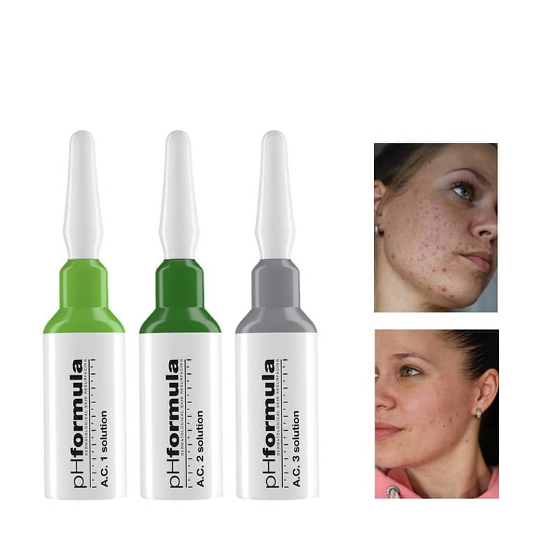 acne11 - Ilusalong Tallinn Iluteenused Meik